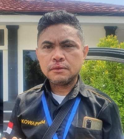  Wartawan Suaraflobamora Dianiaya Usai Jumpa Pers Terkait Deviden PT. Flobamor Rp.1,6 Milyar 