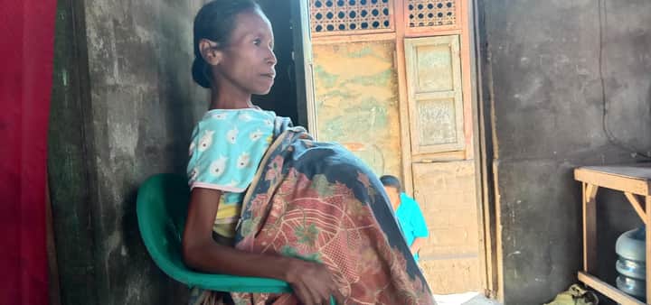Perempuan Penderita Kista Ovarium dan Asites Asal Sikka Butuh Uluran Tangan Kita