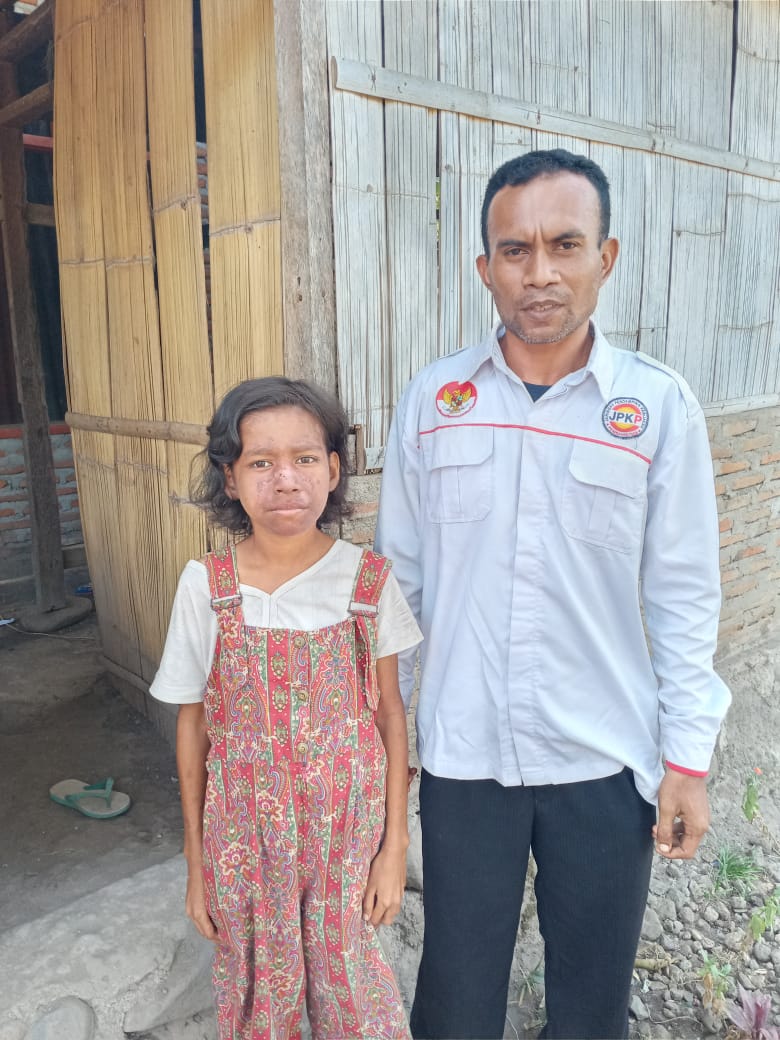 Urus Kemanusiaan Alfred Mere Dapat Apresiasi Dari Keluarga Tania Riti dan Sandro Ahmad