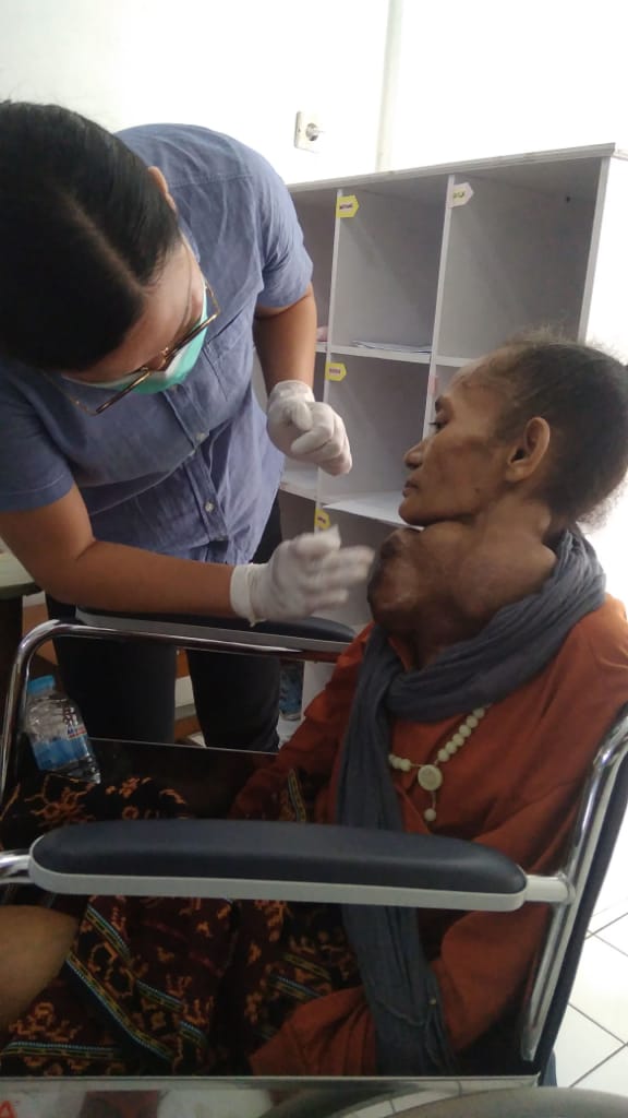 Ibu Gondok dan Lumpuh menahun akhirnya dibawah ke RS oleh JPKP Sikka