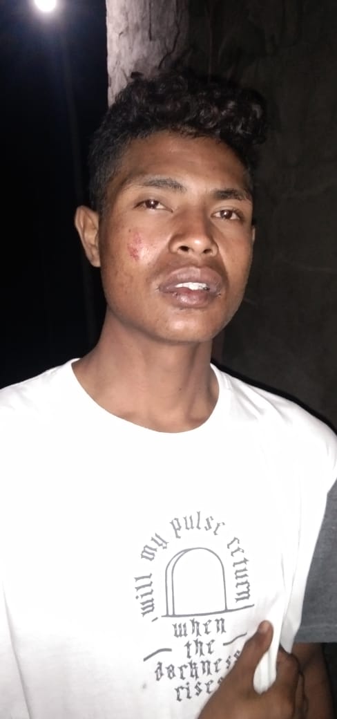 Kejahatan Di Paroki Nurobo Terulang Lagi, Salah Satu OMK Dikeroyok di Desa Leuntolu, Raimanuk 