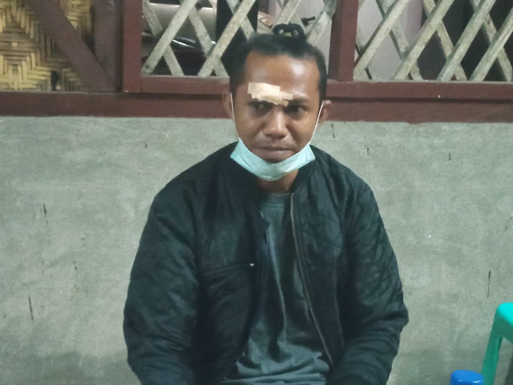 Demi Kebutuhan Hidup, Eman Manda Terpaksa Harus Bekerja Meskipun Pelipis Nya Masih Sakit