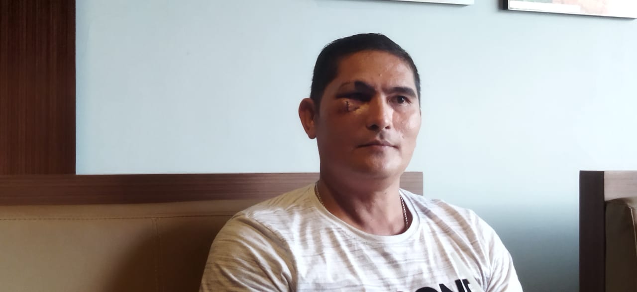 Dianiaya Oknum Polair Polresta Denpasar dan ASN Pemprov NTT, Cornelis Derita 38 Jahitan Luka