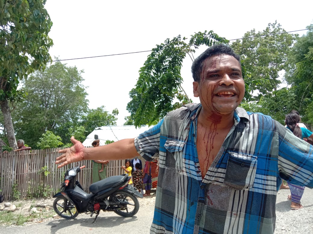 Diduga Mantan Kades Nanin Cs Aniaya Warga Gegara Ditanyakan Soal LPJ Bumdes 