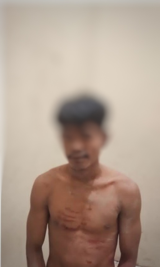 Sadis ! Gara-gara Minum Minuman Keras, Seorang Pria di Kupang Timur Tega Membunuh Temannya