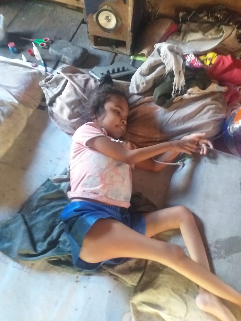 Butuh Perhatian,  Cacat Sejak Lahir, Anak Ini Butuh Uluran Tangan Pemerintah