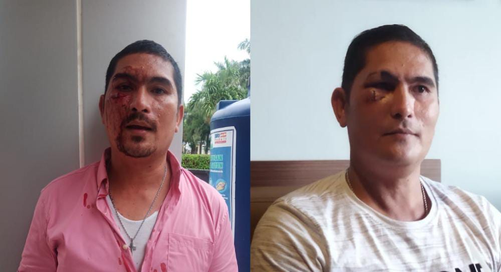 Korban Penganiayaan di Kupang Minta Kapolri Pecat Oknum Polair Polresta Denpasar 