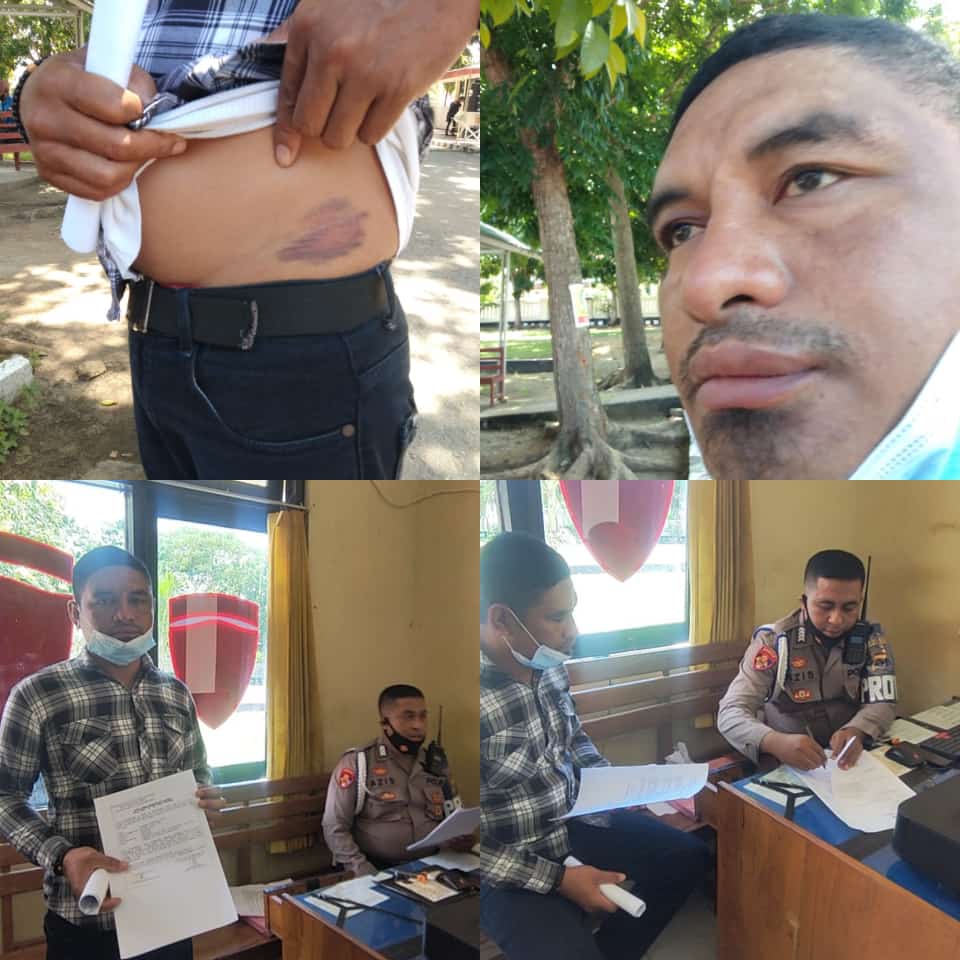 Diduga Aniaya Warga, Oknum Polisi Di Labuan Bajo Dilaporkan Ke Propam 